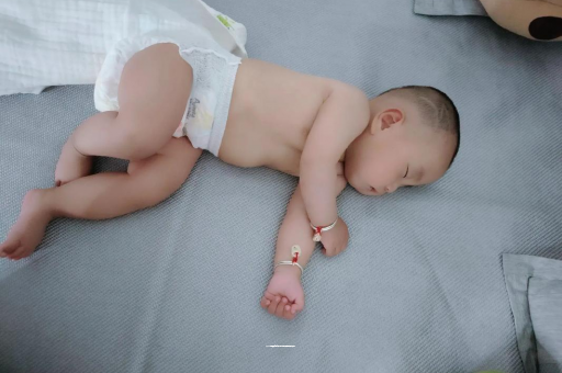 张家界六个月宝宝眼睛散光